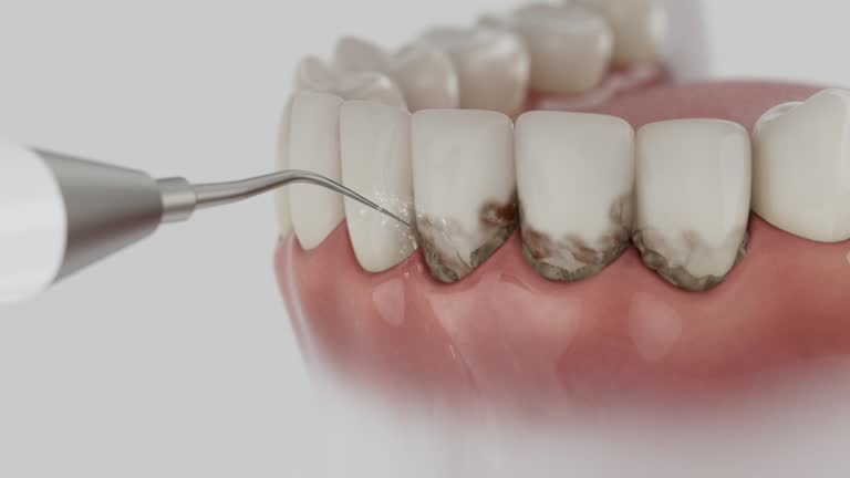 Reliable Wisdom Tooth Removal contractor in Monterey County County, CA by Dentist Open Now